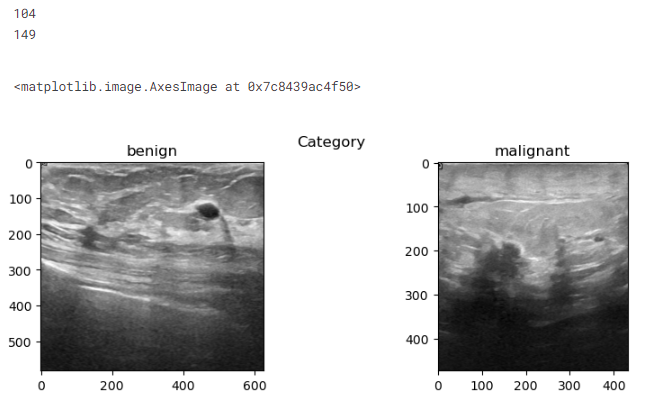 A snippet shows two categories of medical images, benign and malignant. In benign, the horizontal axis ranging 0 to 600, and the vertical axis ranges from 500 to 0. Similarly, in malignant, the horizontal axis ranges from 0 to 400, and the vertical axis ranges from 400 to 0.