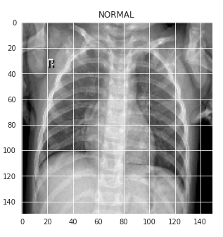 A grided X-ray image of a normal human chest shows two axis. The horizontal axis ranges from 0 to 140, and the vertical axis ranges from 140 to 0. 